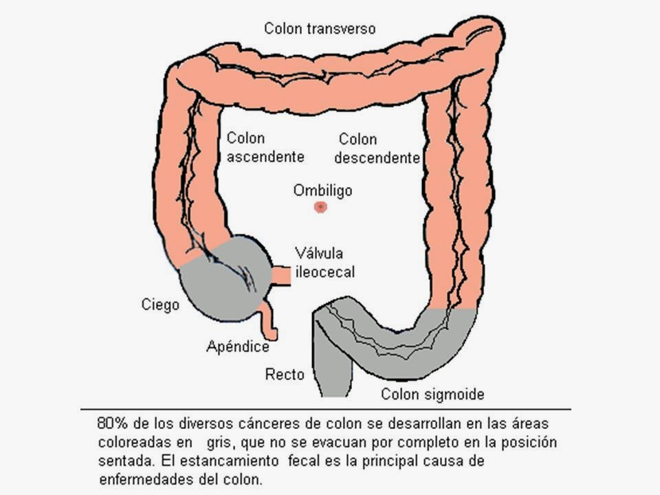 Evacuar para como sentarse